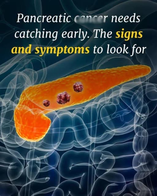 Pancreatic canc3r symptoms you should know, and how the disease develops