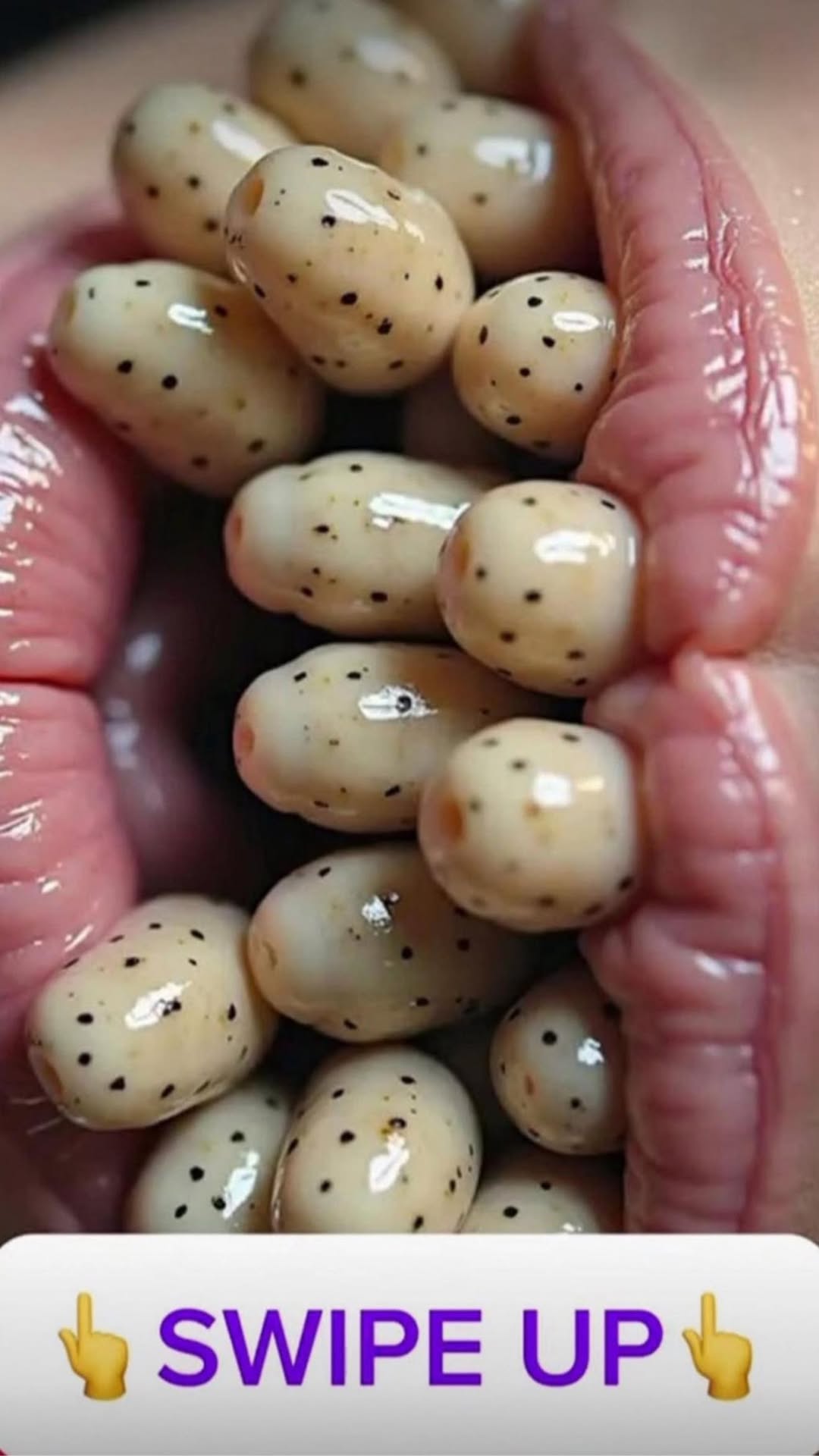 Their acne is severe
