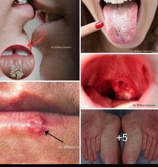 Don’t Underestimate It: Recognizing The Early Signs Of Oral Can…