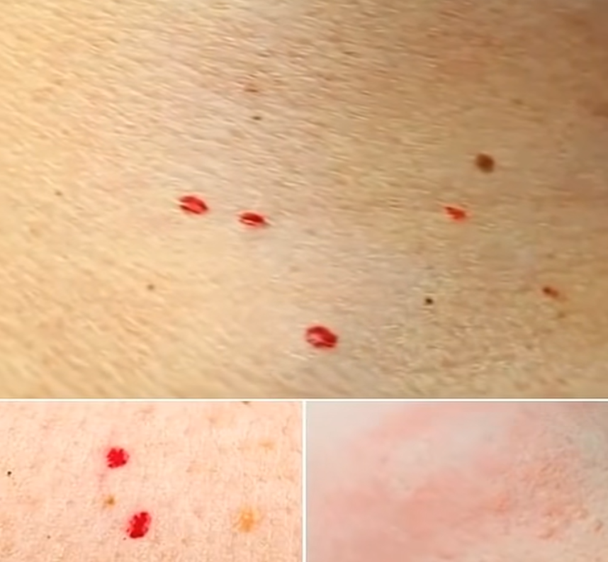 What Those Mysterious Red Dots on Your Skin Could Mean