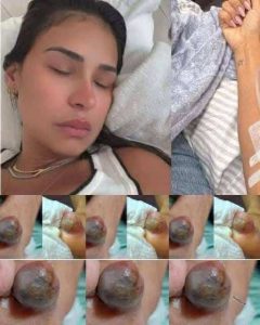 597871338_1315577123947214_4496506124855201290_n