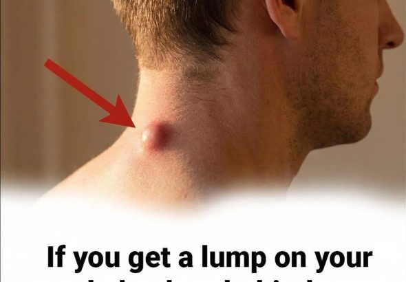 605597816_122201262710332099_8661650160104407891_n