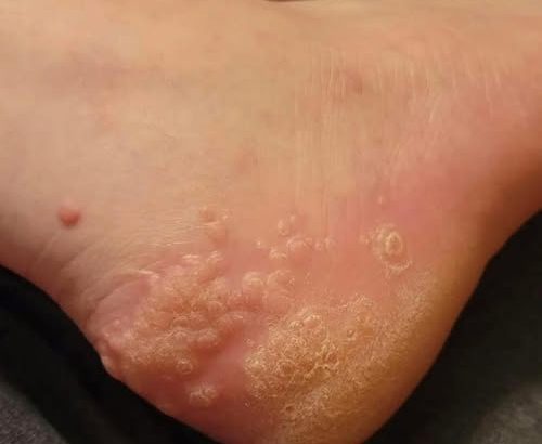 606895067_1296111602538584_4634369154923952434_n