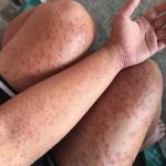 607125692_122304300230011573_7916762793480980939_n-2