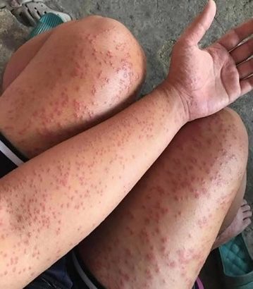 607125692_122304300230011573_7916762793480980939_n-2