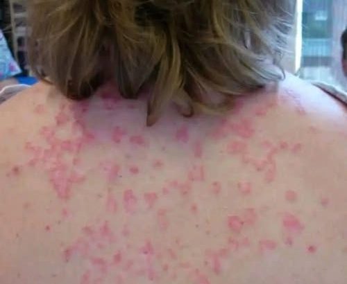 607956889_1299607848855626_4233488857568000860_n