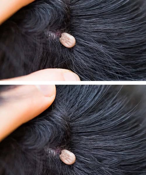 Strange Finding in My Child’s Hair: Should We See a Doctor?