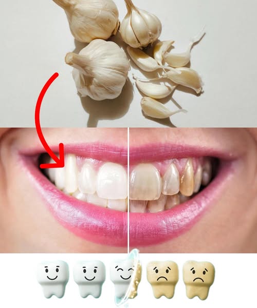 Improve your oral health naturally with garlic