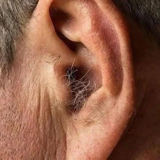 DID YOU KNOW? If hair grows on your ears, it’s because your body is… read more in first comment