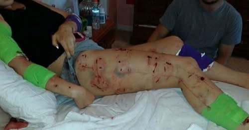 PHOTOS: Women Viciously Attacked During 30-Minute ‘Feeding Frenzy’