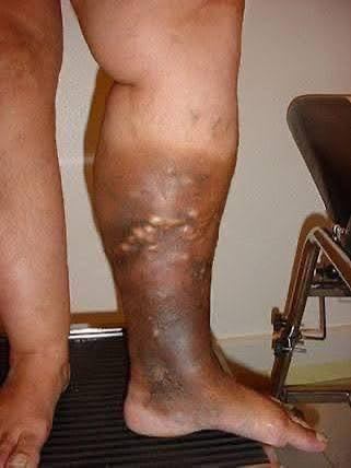 These are the signs that he is cr… See more