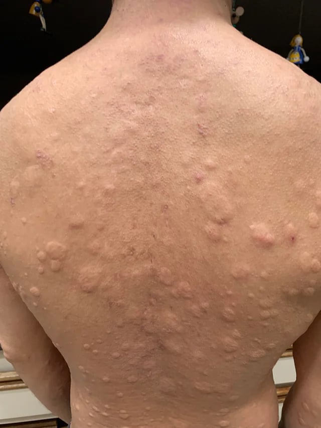 Unexpected Consequences of Sleeping with the Wrong Person”