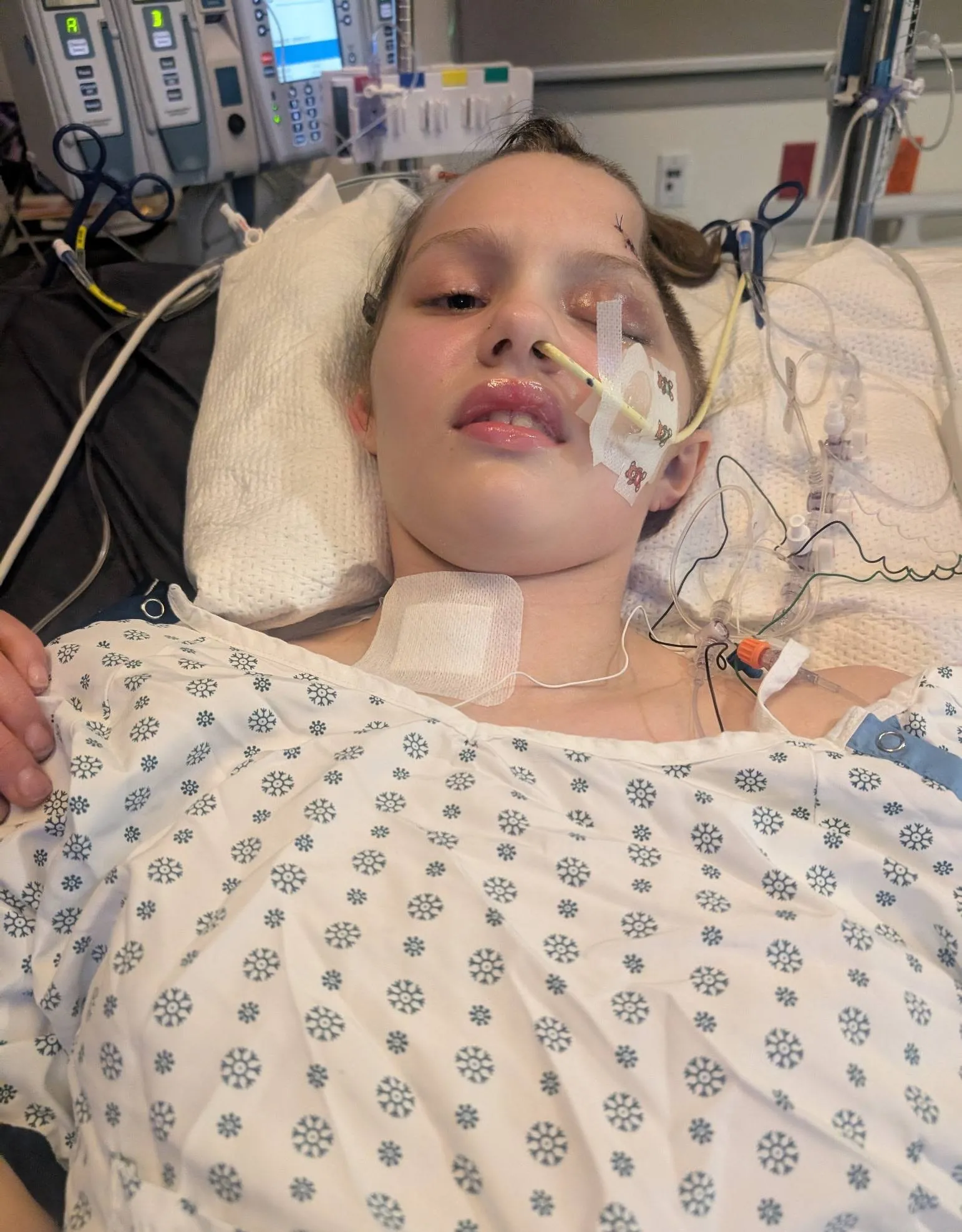 Surgery Suddenly Canceled — Young Girl’s Fight Takes Heartbreaking Turn as Infection Worsens