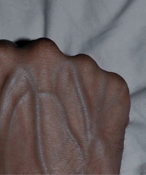 If your veins are visible in your hand, it is a signal of ca… See more