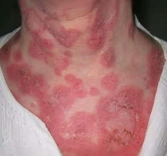 These are the consequences of sleeping with the… See more