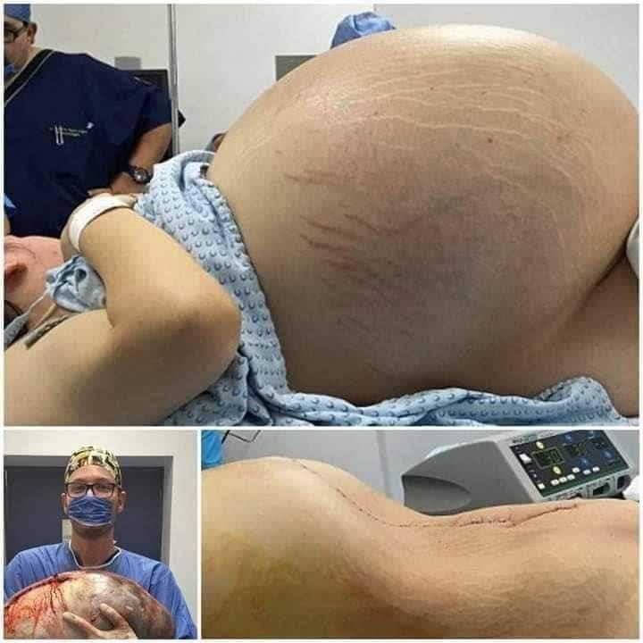 She cried with happiness, they told her she was pregnant with triplets, but the… See more