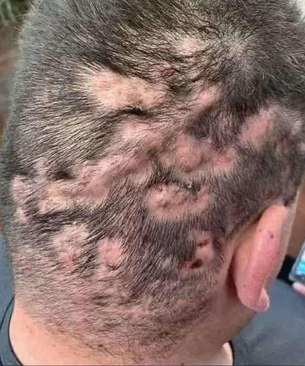 These are the first symptoms