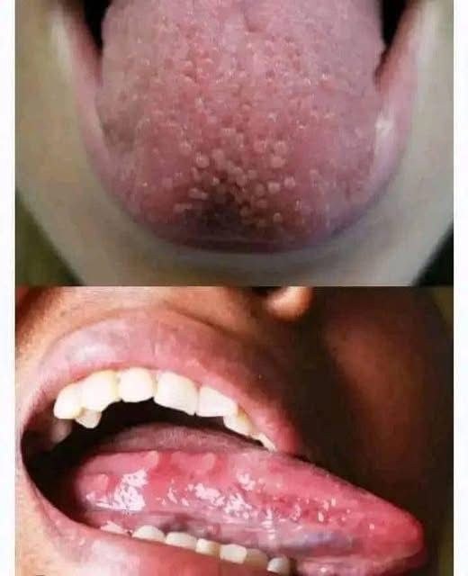 8 Things That Your Tongue Tell You About Your Health…