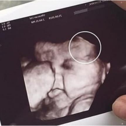 Mother is scared to see her daughter’s ultrasound; image showed the… See more