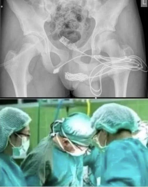 Curious Teenager Hospitalized After Making a Dangerous Mistake with an Everyday Household Object Leading to Urgent Warnings from Top Surgeons 